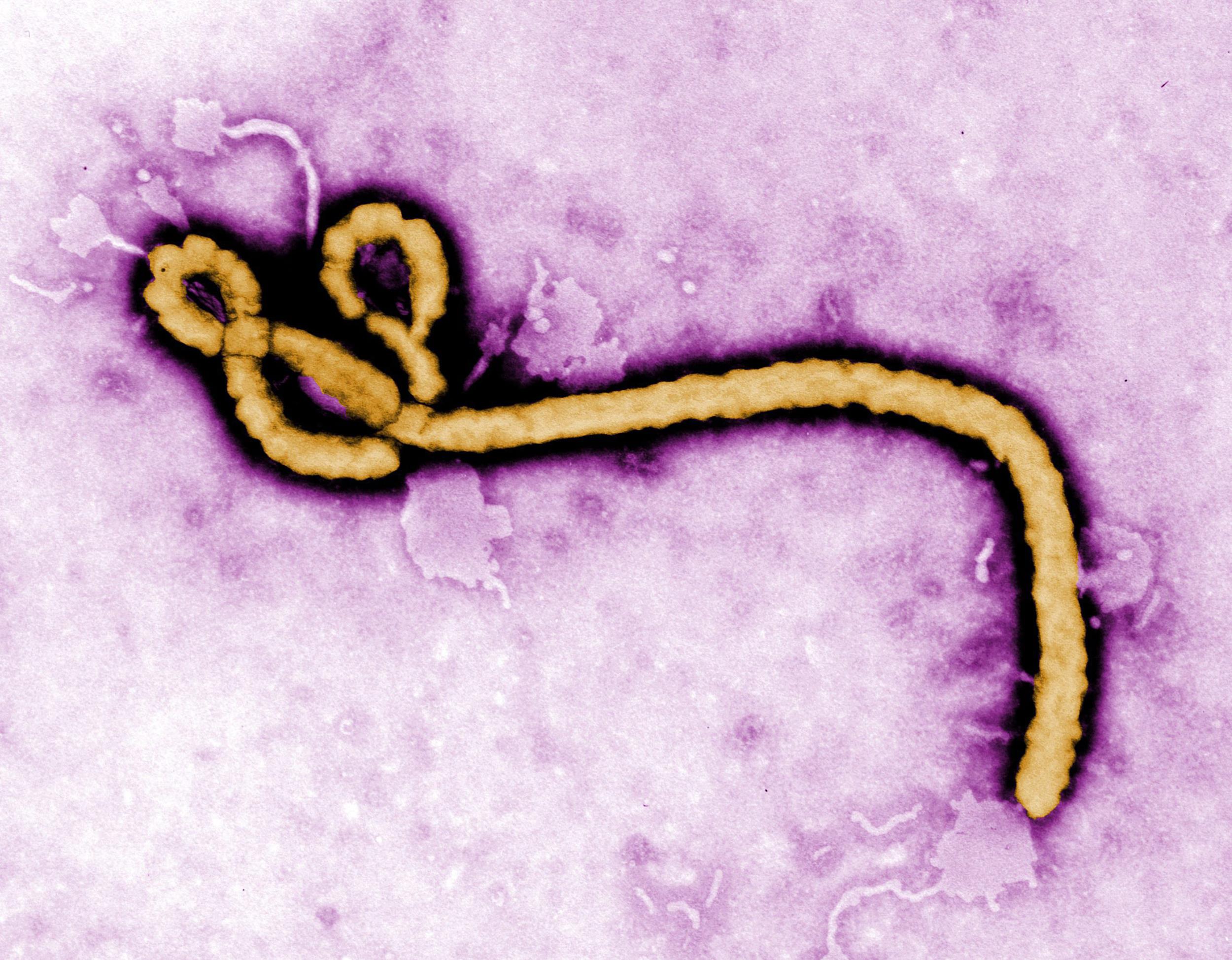 La réponse de la France à la crise Ebola manque de transparence